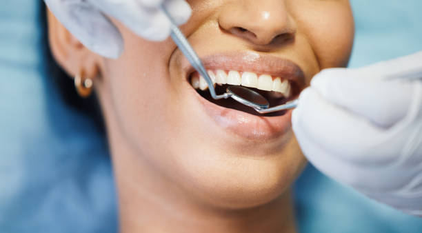 Best Emergency Denture Repair in Blue Jay, OH